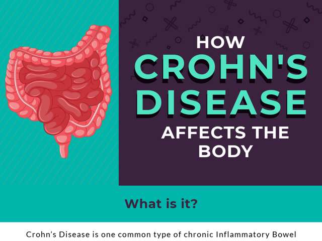  How Crohn’s Disease Affects the Body